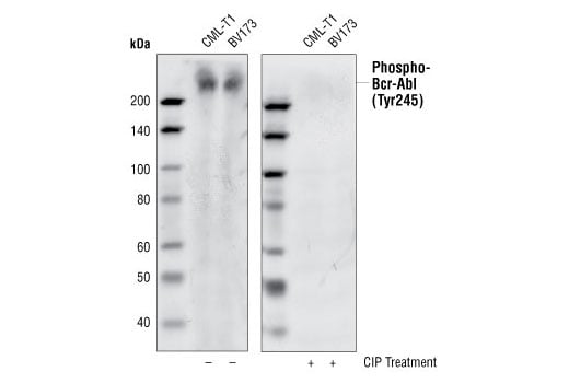 Western Blotting Image 2: Phospho-c-Abl (Tyr245) (73E5) Rabbit mAb