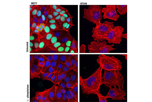 Immunofluorescence Image 1: Phospho-Rb (Ser807/811) (D20B12) XP<sup>®</sup> Rabbit mAb (BSA and Azide Free)