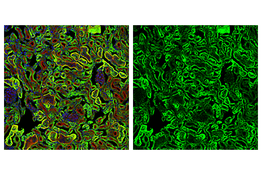 Immunofluorescence Image 2: MAVS (E8Z7M) Rabbit mAb