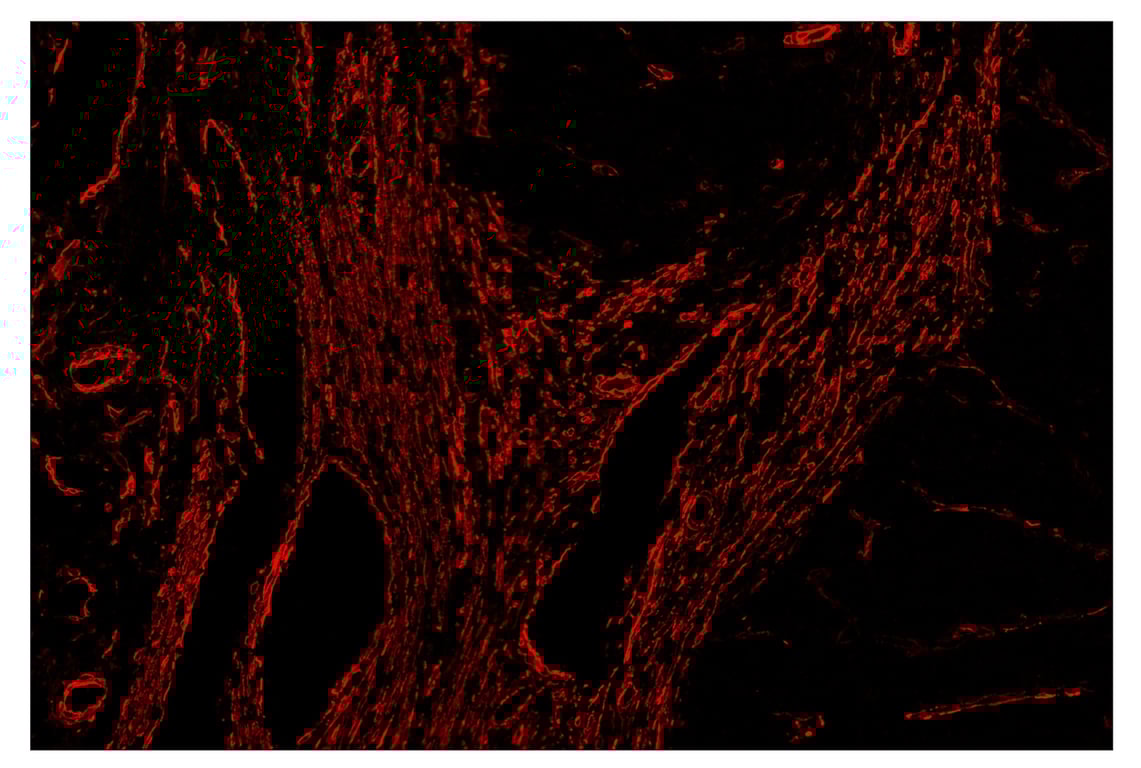 Immunohistochemistry Image 5: α-Smooth Muscle Actin (D4K9N) & CO-0024-488 SignalStar<sup>™</sup> Oligo-Antibody Pair