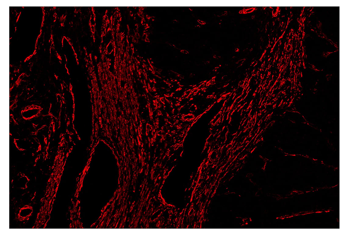 Immunohistochemistry Image 5: α-Smooth Muscle Actin (D4K9N) & CO-0024-594 SignalStar<sup>™</sup> Oligo-Antibody Pair