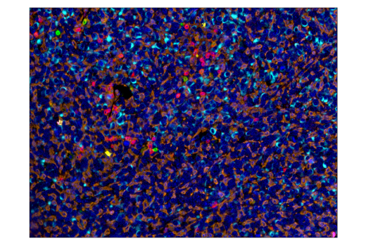Immunohistochemistry Image 4: F4/80 (D2S9R) XP<sup>®</sup> Rabbit mAb (BSA and Azide Free)