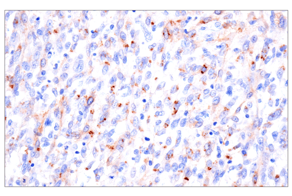 Immunohistochemistry Image 11: FAP (F1A4G) Rabbit mAb