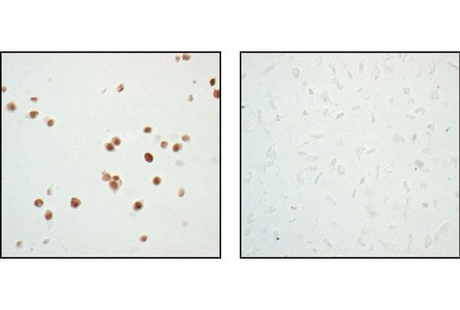 undefined Image 8: PhosphoPlus<sup>®</sup> p53 (Ser15) Antibody Duet