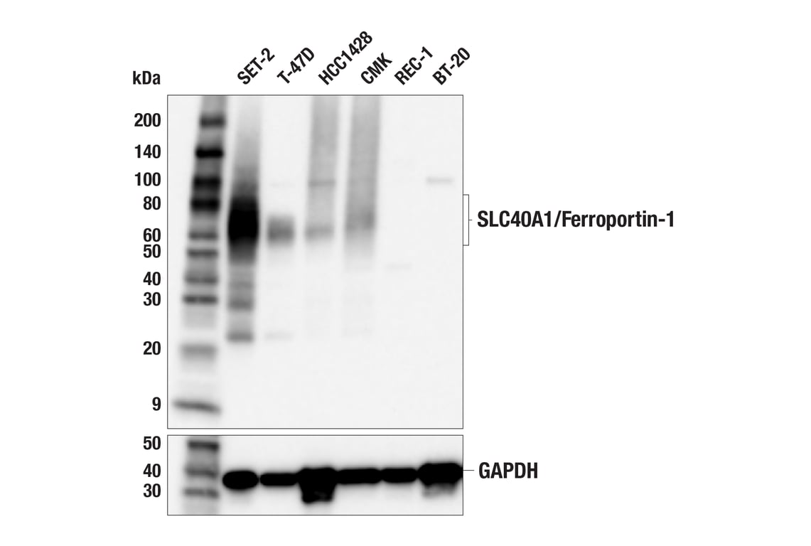 Western Blotting Image 1: SLC40A1/Ferroportin-1 (F9U5S) Rabbit mAb