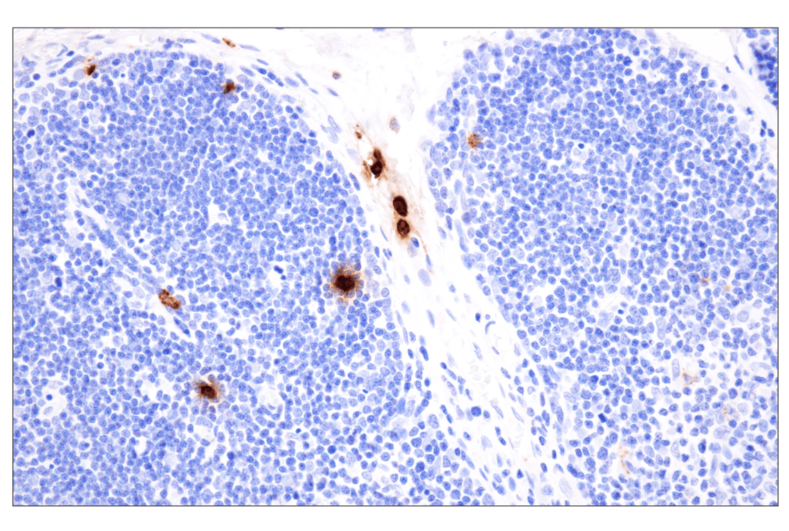 Immunohistochemistry Image 7: Neutrophil Elastase (F4H3X) Rabbit mAb (BSA and Azide Free)