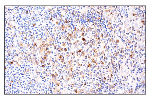 Immunohistochemistry Image 3: Phospho-SLP-76 (Ser376) (E3G9U) XP<sup>®</sup> Rabbit mAb