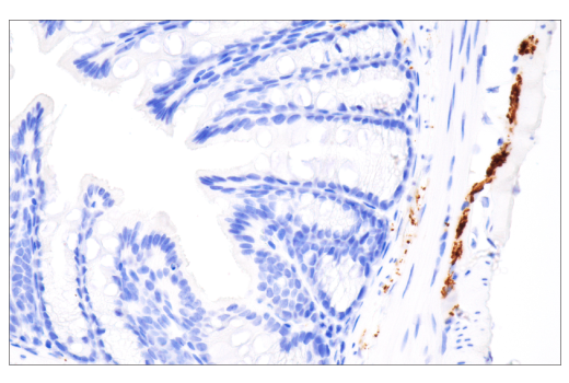 Immunohistochemistry Image 2: Tyrosine Hydroxylase (E2L6M) Rabbit mAb