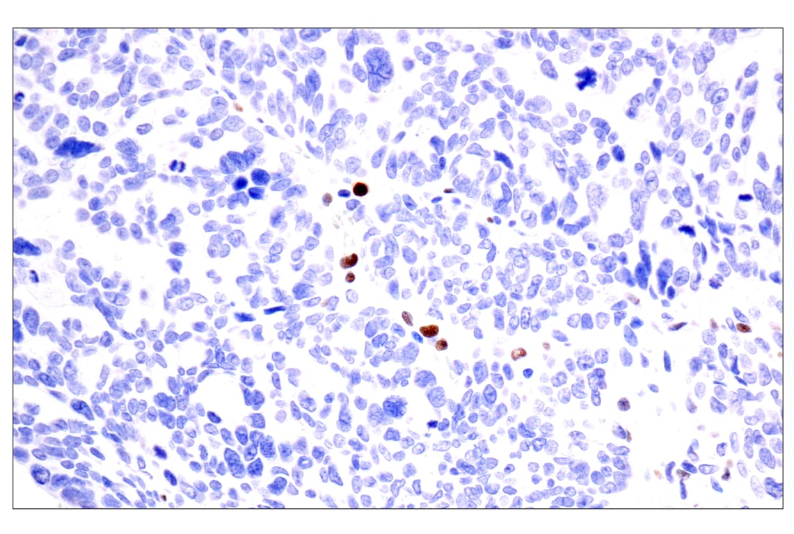 Immunohistochemistry Image 4: BATF3 (E3F3L) Rabbit mAb