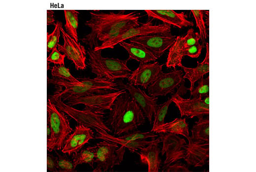 Immunofluorescence Image 1: Topoisomerase IIα (D10G9) XP<sup>®</sup> Rabbit mAb