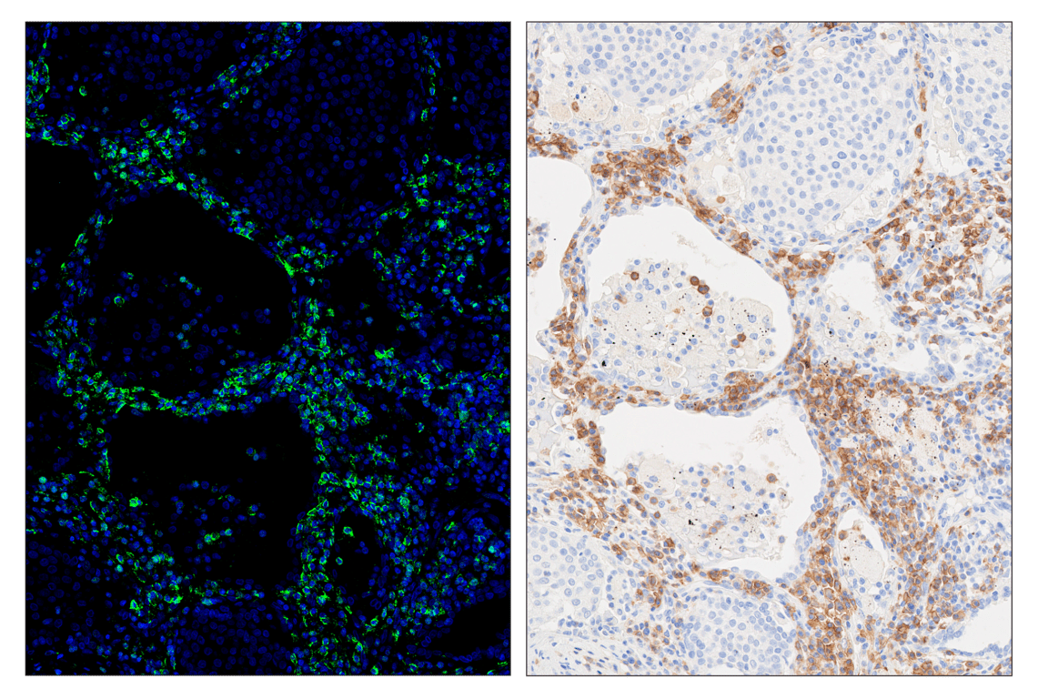 Immunohistochemistry Image 5: CD19 (Intracellular Domain) (D4V4B) & CO-0054-594 SignalStar<sup>™</sup> Oligo-Antibody Pair