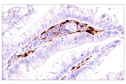Immunohistochemistry Image 3: S100B (E7C3A) Rabbit mAb