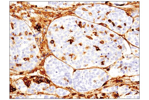 Immunohistochemistry Image 4: CD163 (D6U1J) Rabbit mAb