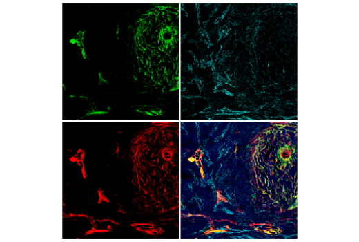 Immunofluorescence Image 1: COL1A1 (E8F4L) XP<sup>®</sup> Rabbit mAb (BSA and Azide Free)