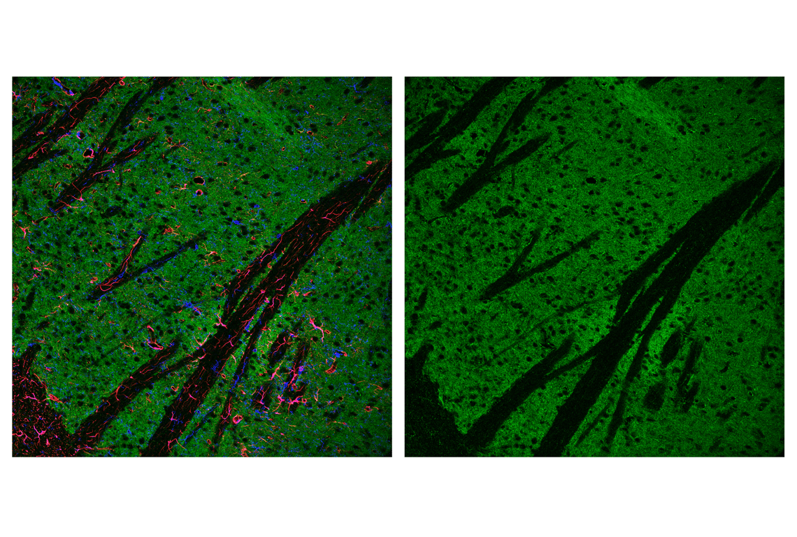 undefined Image 31: Cell Fractionation Antibody Sampler Kit