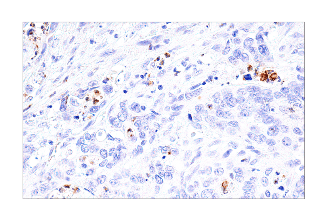 Immunohistochemistry Image 7: IL-8 (E5F5Q) XP<sup>®</sup> Rabbit mAb (BSA and Azide Free)