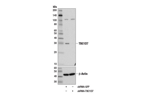Western Blotting Image 2: TBC1D7 (D8K1Y) Rabbit mAb