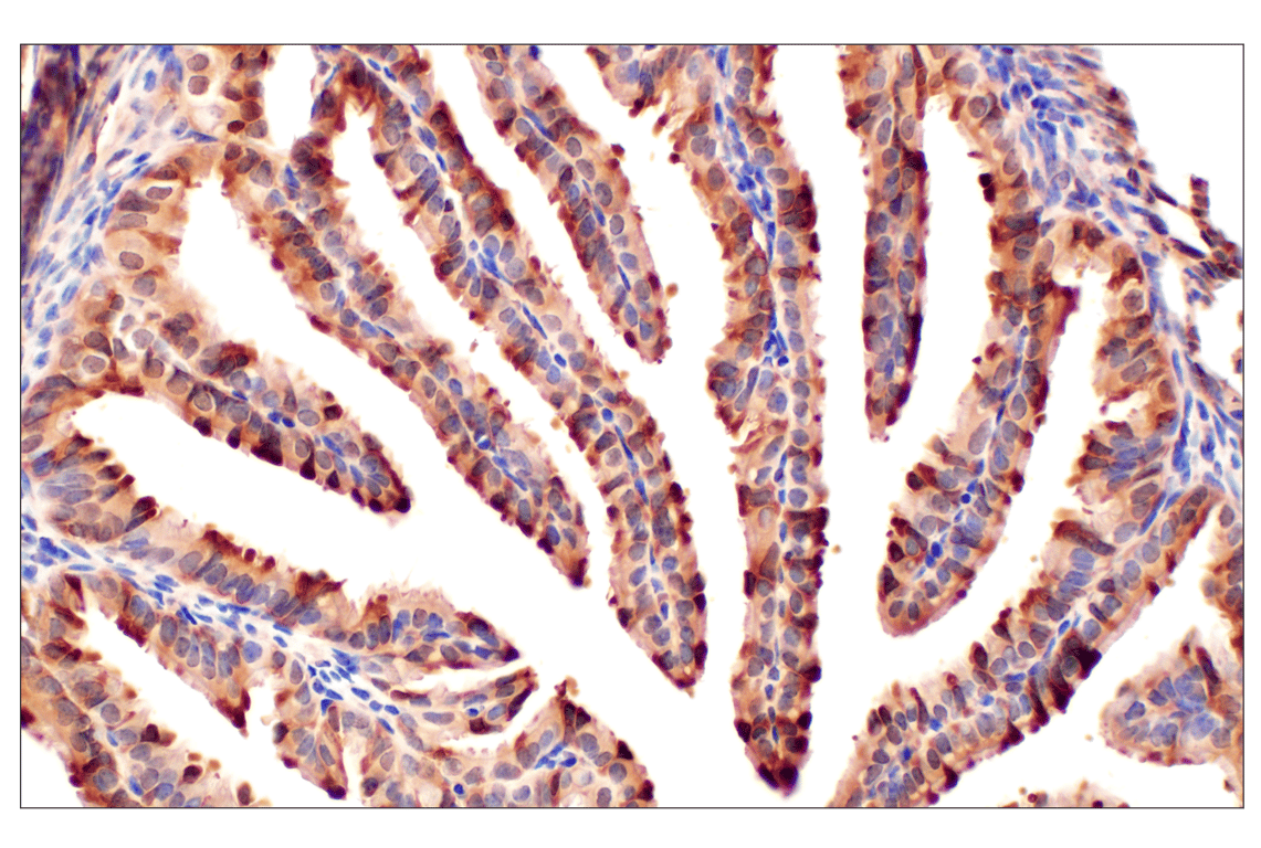 Immunohistochemistry Image 11: MTAP (E5R1I) Rabbit mAb (BSA and Azide Free)