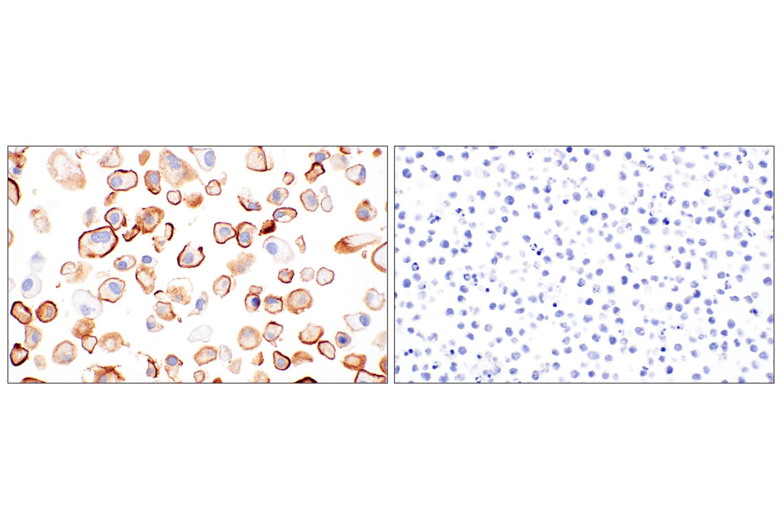 Immunohistochemistry Image 4: UPK3B (DBRRM3.66) Rabbit mAb
