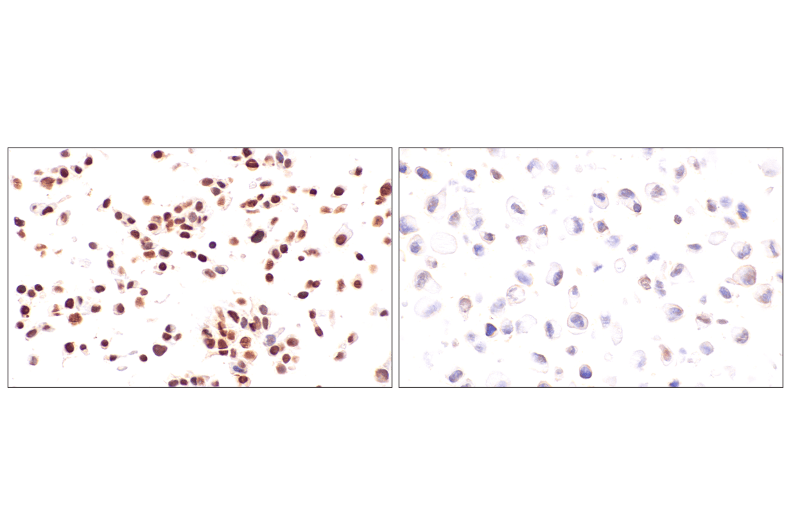Immunohistochemistry Image 19: FoxA1/HNF3α (IHC578) Mouse mAb
