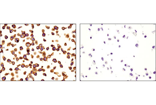 Immunohistochemistry Image 1: CD46 (D6N7H) Rabbit mAb