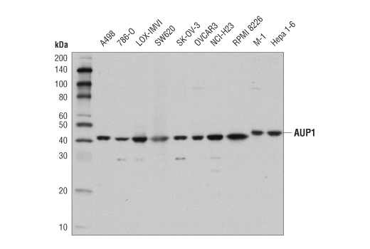 Western Blotting Image 1: AUP1 (D5M9Q) Rabbit mAb