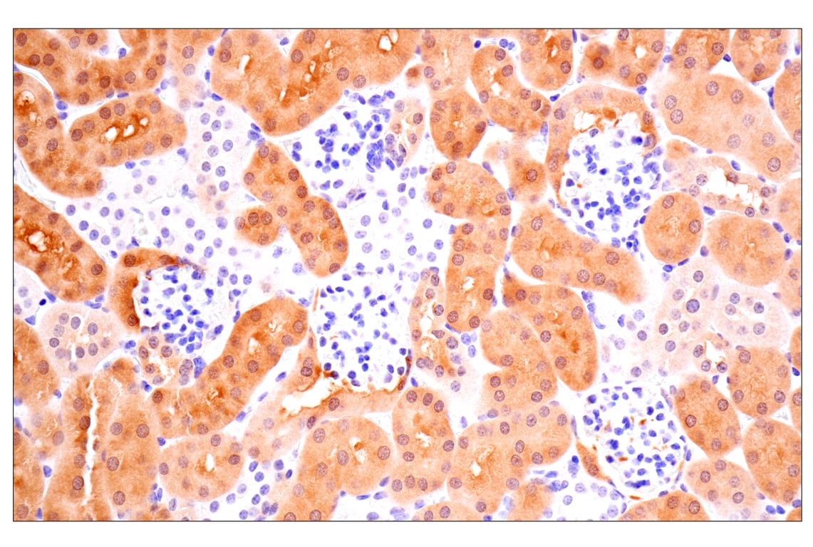 Immunohistochemistry Image 13: ACBP/DBI (E4V8V) XP<sup>®</sup> Rabbit mAb