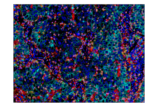 undefined Image 40: Microglia Neurodegeneration Module Antibody Sampler Kit
