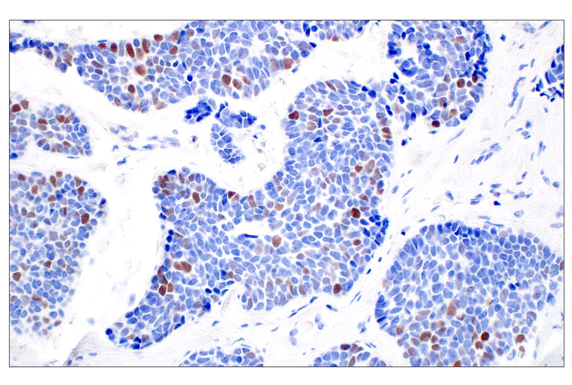 Immunohistochemistry Image 6: BRCA1 (E5S9G) Rabbit mAb