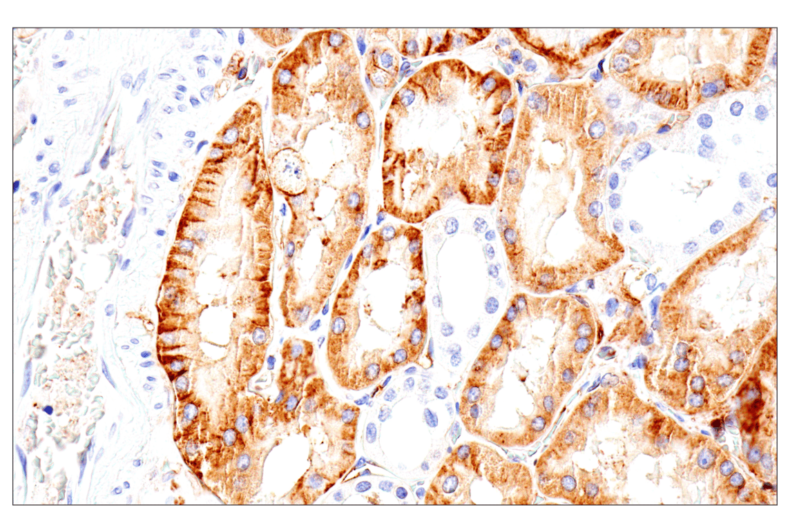 Immunohistochemistry Image 14: Syndecan 1 (E7F7T) Rabbit mAb