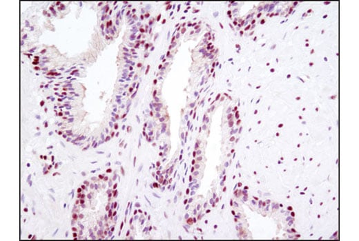 undefined Image 34: Mouse Reactive Pyroptosis Antibody Sampler Kit