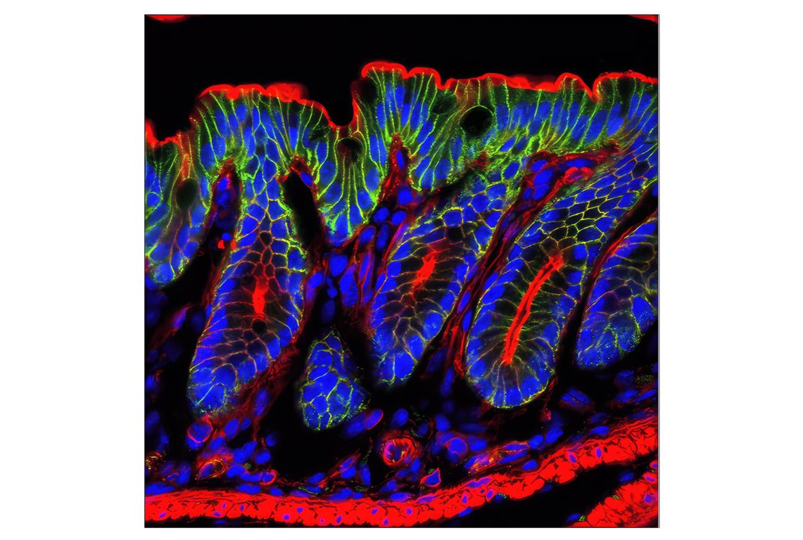 undefined Image 49: Cadherin-Catenin Antibody Sampler Kit