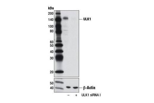 undefined Image 2: SignalSilence<sup>®</sup> ULK1 siRNA I