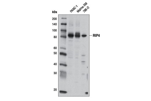 Western Blotting Image 1: RIP4 Antibody
