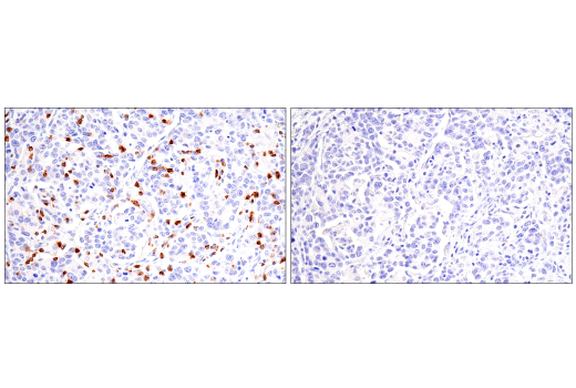 Immunohistochemistry Image 5: CD7 (LP15) Mouse mAb