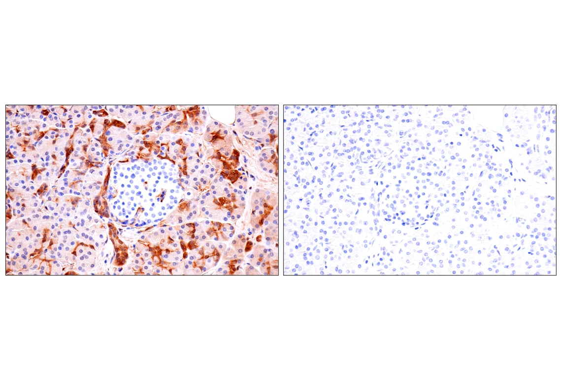 Immunohistochemistry Image 13: Phospho-YAP (Ser61) (E4Q8S) Rabbit mAb