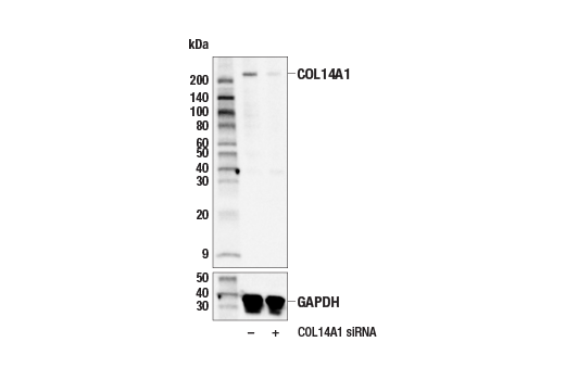 Western Blotting Image 1: COL14A1 (E5W8S) Rabbit mAb (BSA and Azide Free)