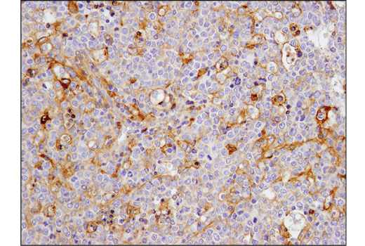 Immunohistochemistry Image 2: CD40 (D8W3N) Rabbit mAb