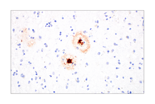 Immunohistochemistry Image 1: β-Amyloid (1-42) (E6D5M) Rabbit mAb