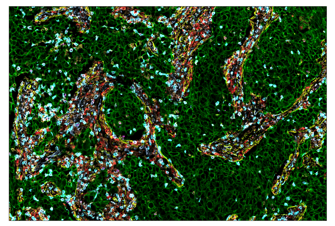 Immunohistochemistry Image 1: HER2/ErbB2 (D8F12) & CO-0059-488 SignalStar™ Oligo-Antibody Pair