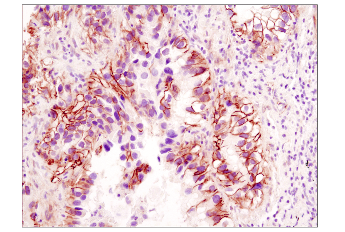 Immunohistochemistry Image 1: β-Catenin (D10A8) XP<sup>®</sup> Rabbit mAb (BSA and Azide Free)