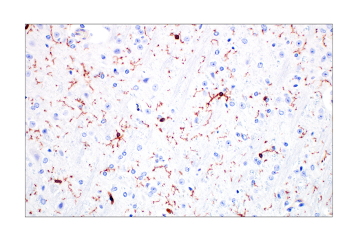 Immunohistochemistry Image 5: Integrin β2 (E9O7W) Rabbit mAb (BSA and Azide Free)