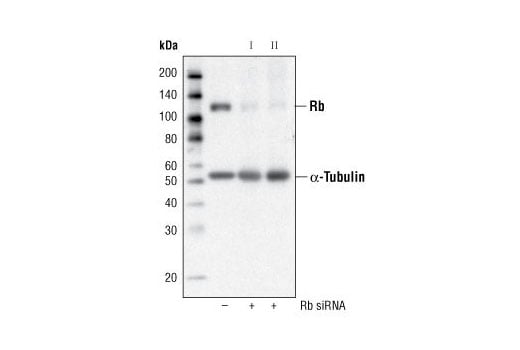 Western Blotting Image 2: Rb (4H1) Mouse mAb