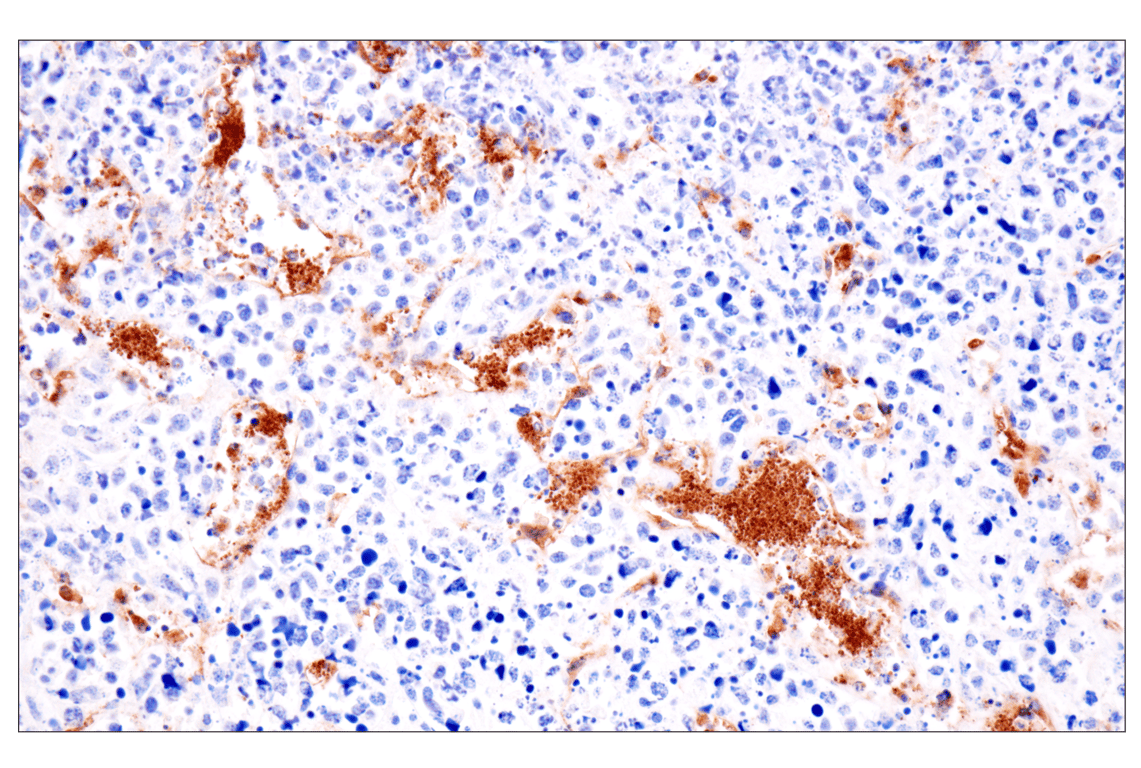 Immunohistochemistry Image 3: ESAM (F9D9P) Rabbit mAb