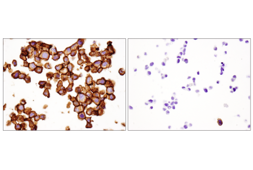 Immunohistochemistry Image 5: B7-H3 (D9M2L) XP<sup>®</sup> Rabbit mAb (BSA and Azide Free)