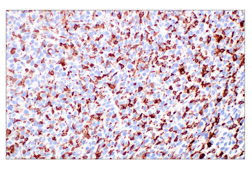 Immunohistochemistry Image 4: CD206/MRC1 (E6T5J) XP<sup>®</sup> Rabbit mAb (BSA and Azide Free)