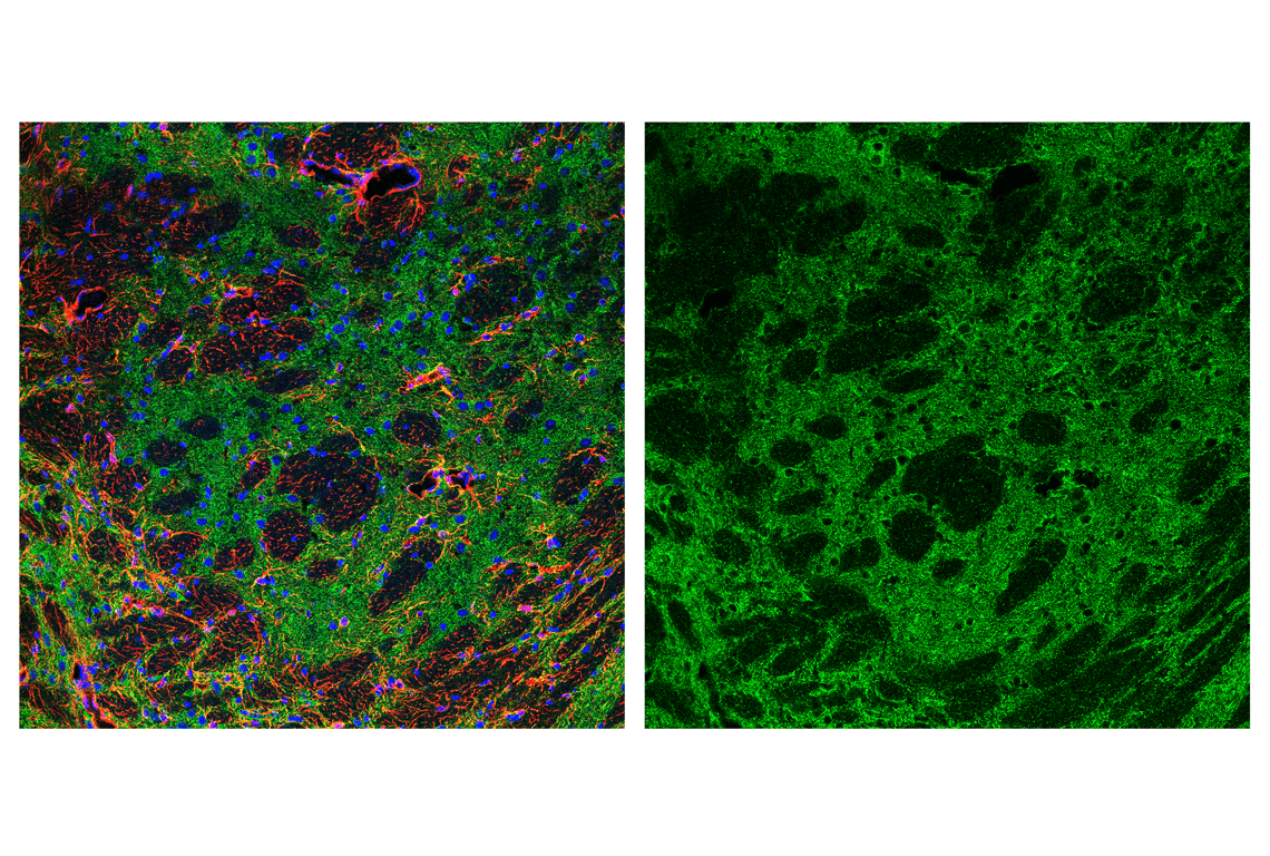undefined Image 34: Cell Fractionation Antibody Sampler Kit