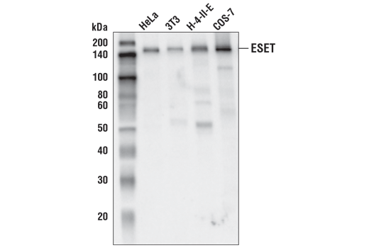 Western Blotting Image 1: ESET (D4M8R) XP<sup>®</sup> Rabbit mAb