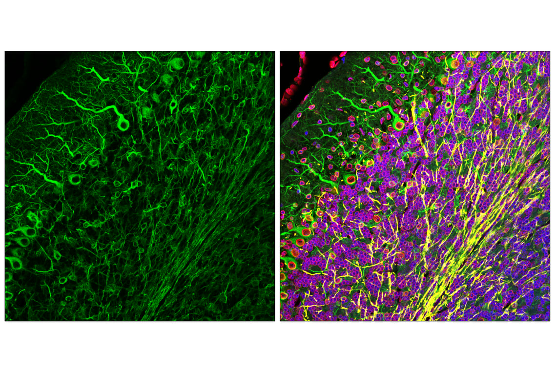 Immunofluorescence Image 2: β3-Tubulin (E9F3E) Mouse mAb (BSA and Azide Free)