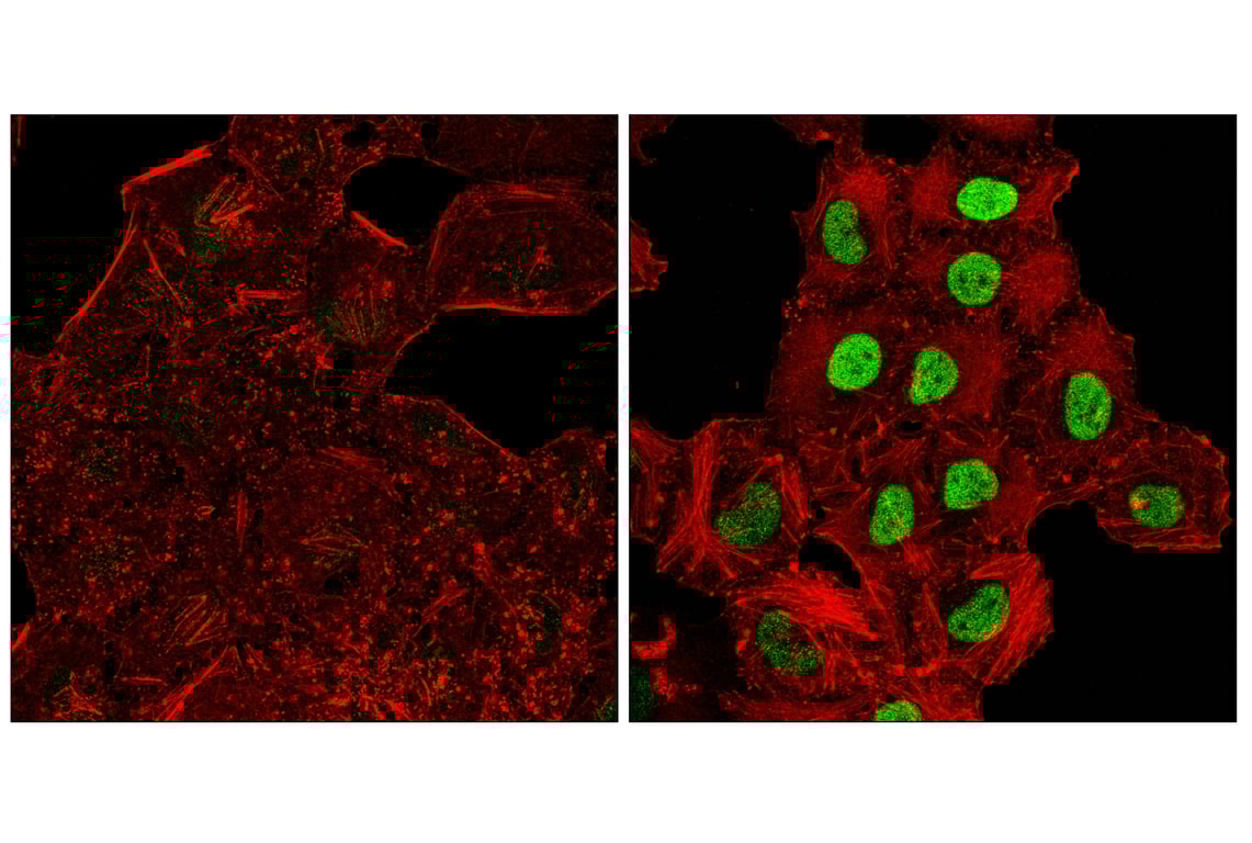 Immunofluorescence Image 1: c-Fos (E2I7R) XP<sup>®</sup> Rabbit mAb